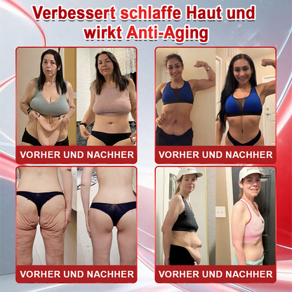 🇩🇪 Offizielle croaie® 🎀 𝐆𝐿𝑷-𝟭 + Kollagenpeptide Lösung zur Unterstützung von Gewichtsmanagement und Hautstraffung – mit Kollagenpeptiden & Matrixyl 3000. Hilft, das Wohlbefinden zu unterstützen und die Haut sichtbar zu verbessern.