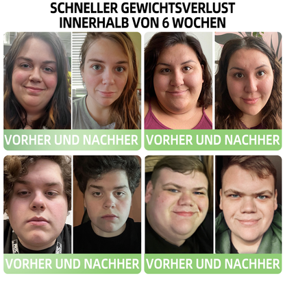 [Offizieller Shop] 𝐇𝐎𝐍𝐗𝐈® 𝐆𝐋𝐏-𝟏 𝐌𝐨𝐫𝐢𝐧𝐠𝐚 𝐒𝐜𝐡𝐥𝐚𝐧𝐤𝐡𝐞𝐢𝐭𝐬- 𝐮𝐧𝐝 𝐆𝐞𝐬𝐮𝐧𝐝𝐡𝐞𝐢𝐭𝐬𝐬𝐭𝐞𝐢𝐠𝐞𝐫𝐮𝐧𝐠𝐬-𝐓𝐫𝐨𝐩𝐟𝐞𝐧 (Lebensmittelgeeigneter Fettverbrenner – Entwickelt von der Gesellschaft für Flexibilität)