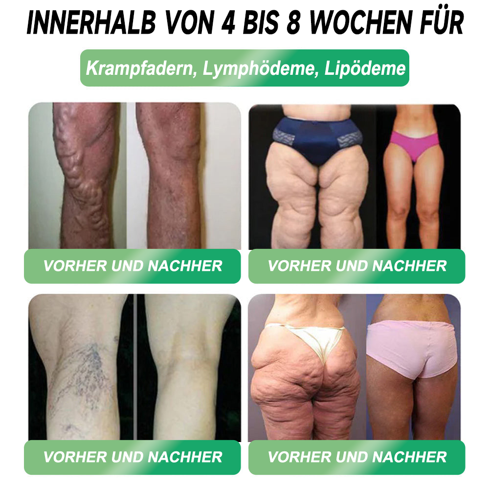 Berlin Health®  GLP-1 Sechs-in-Eins Gesundheitslösung Orallösung (🌿 Nur einmal täglich – sichtbare Veränderungen in nur 7 Tagen) ✅ Geeignet für: Übergewicht, Diabetes und verschiedene Gesundheitsbedürfnisse