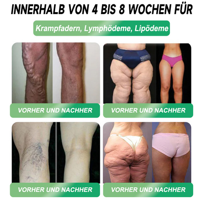 Berlin Health®  GLP-1 Sechs-in-Eins Gesundheitslösung Orallösung (🌿 Nur einmal täglich – sichtbare Veränderungen in nur 7 Tagen) ✅ Geeignet für: Übergewicht, Diabetes und verschiedene Gesundheitsbedürfnisse