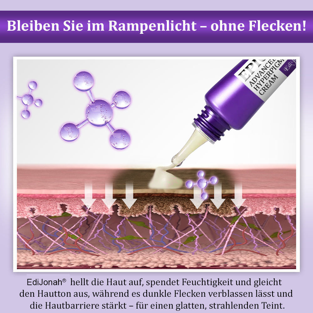 💜✅𝐊𝐁𝐕 𝐙𝐮𝐥𝐚𝐬𝐬𝐮𝐧𝐠 | 𝐄𝐝𝐢𝐉𝐨𝐧𝐚𝐡®𝐄𝐏𝐈𝐆𝐋𝐎𝐖 𝐌𝐞𝐥𝐚𝐧𝐄𝐗 𝐅𝐨𝐫𝐭𝐬𝐜𝐡𝐫𝐢𝐭𝐭𝐥𝐢𝐜𝐡𝐞 𝐀𝐧𝐭𝐢-𝐇𝐲𝐩𝐞𝐫𝐩𝐢𝐠𝐦𝐞𝐧𝐭𝐢𝐞𝐫𝐮𝐧𝐠𝐬 𝐂𝐫𝐞𝐦𝐞