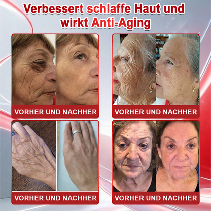 🇩🇪 Offizielle croaie® 🎀 𝐆𝐿𝑷-𝟭 + Kollagenpeptide Lösung zur Unterstützung von Gewichtsmanagement und Hautstraffung – mit Kollagenpeptiden & Matrixyl 3000. Hilft, das Wohlbefinden zu unterstützen und die Haut sichtbar zu verbessern.