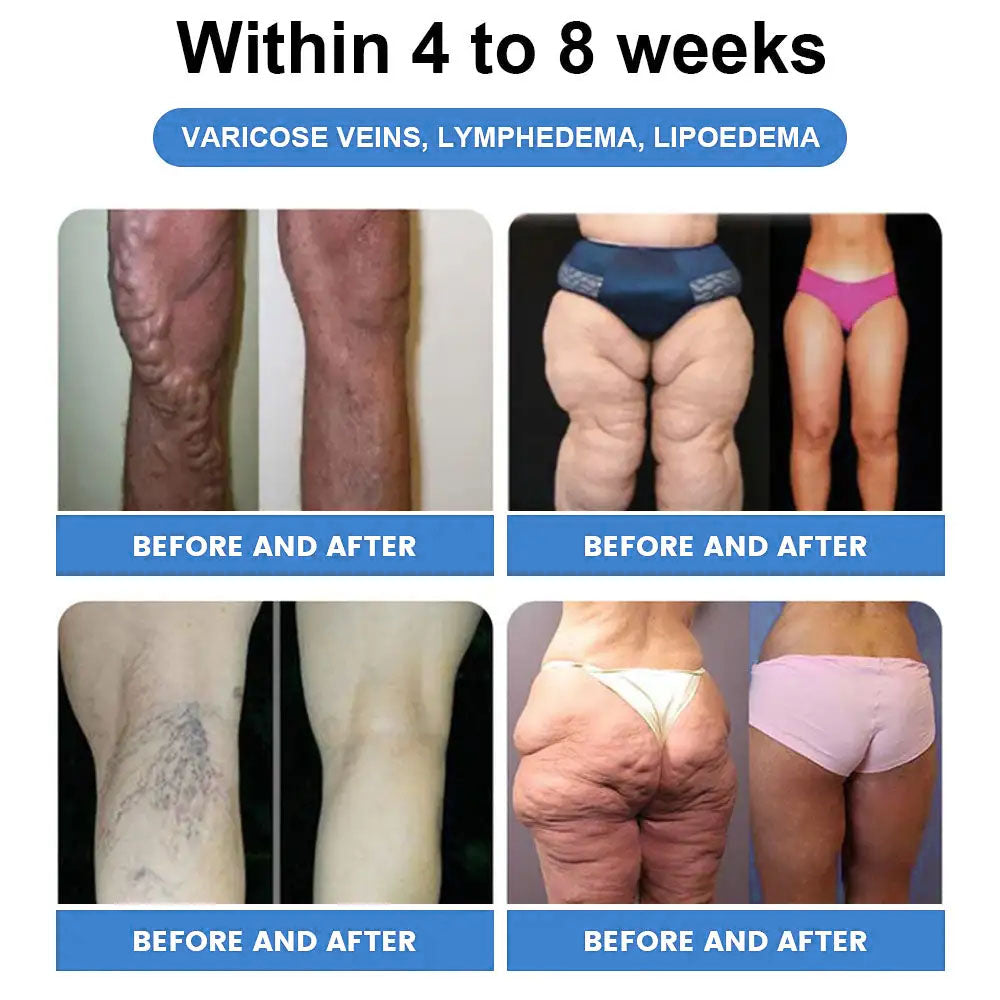 ✅𝐶𝑅𝑂𝐴𝐼𝐸® GLP-1 SCHLANKHEITS- UND GESUNDHEITSTROPFEN 🌸 Nur 1x pro Woche, erste Veränderungen in 7 Tagen sichtbar ✅ Für Adipositas, Herz-Kreislauf, Diabetes, Schlafapnoe, Gelenke und mehr