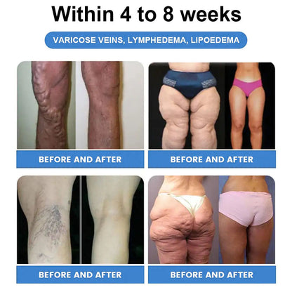 ✅𝐶𝑅𝑂𝐴𝐼𝐸® GLP-1 SCHLANKHEITS- UND GESUNDHEITSTROPFEN 🌸 Nur 1x pro Woche, erste Veränderungen in 7 Tagen sichtbar ✅ Für Adipositas, Herz-Kreislauf, Diabetes, Schlafapnoe, Gelenke und mehr