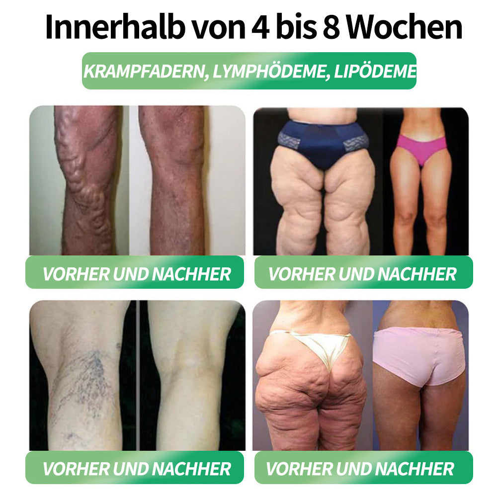 🇩🇪 Offizieller Shop – CROAIE® GLP-1 Schlankheitslösung zum Einnehmen Für Adipositas, Herz-Kreislauf-Erkrankungen, Diabetes, Schlafapnoe, Gelenkprobleme und mehr 🔥