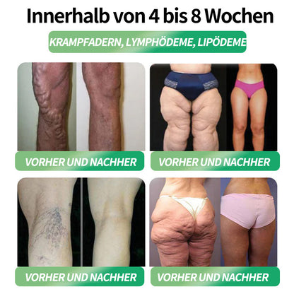 🇩🇪 Offizieller Shop – CROAIE® GLP-1 Schlankheitslösung zum Einnehmen Für Adipositas, Herz-Kreislauf-Erkrankungen, Diabetes, Schlafapnoe, Gelenkprobleme und mehr 🔥