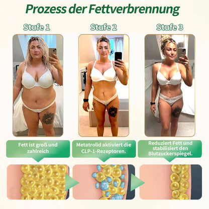 🇩🇪 Offizieller Shop – CROAIE® GLP-1 Schlankheitslösung zum Einnehmen Für Adipositas, Herz-Kreislauf-Erkrankungen, Diabetes, Schlafapnoe, Gelenkprobleme und mehr 🔥