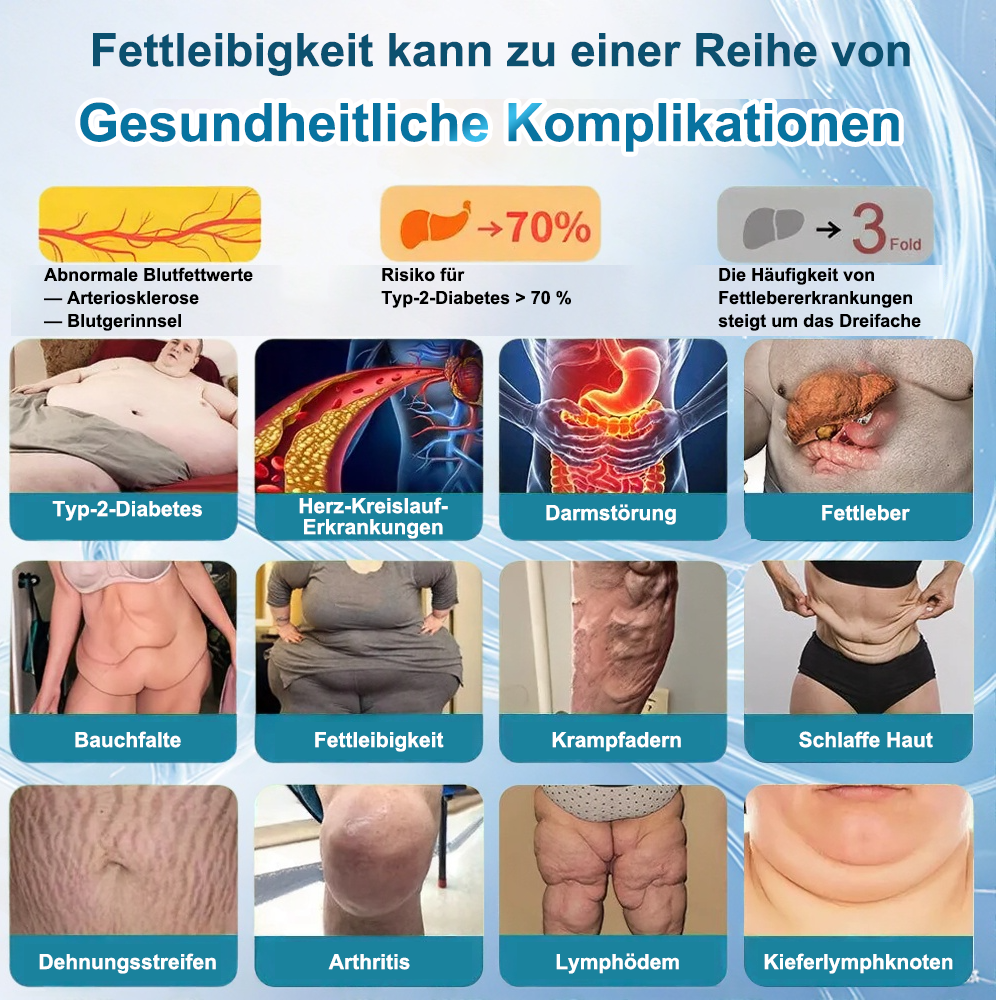 Online🔥 | VIVIREAL® 𝐆𝐋𝐏-𝟏 𝐃𝐫𝐞𝐢𝐟𝐚𝐜𝐡-𝐀𝐠𝐨𝐧𝐢𝐬𝐭 𝐌𝐮𝐥𝐭𝐢𝐟𝐮𝐧𝐤𝐭𝐢𝐨𝐧𝐚𝐥𝐞 𝐎𝐫𝐚𝐥𝐥ö𝐬𝐮𝐧𝐠 (𝐍ä𝐜𝐡𝐬𝐭𝐞 𝐆𝐞𝐧𝐞𝐫𝐚𝐭𝐢𝐨𝐧 𝐆𝐋𝐏-𝟏 × 𝐆𝐈𝐏 × 𝐆𝐂𝐆 𝐀𝐠𝐨𝐧𝐢𝐬𝐭) ✅ 𝐅ü𝐫 𝐅𝐞𝐭𝐭𝐥𝐞𝐢𝐛𝐢𝐠𝐤𝐞𝐢𝐭, 𝐇𝐞𝐫𝐳-𝐊𝐫𝐞𝐢𝐬𝐥𝐚𝐮𝐟-𝐆𝐞𝐬𝐮𝐧𝐝𝐡𝐞𝐢𝐭, 𝐃𝐢𝐚𝐛𝐞𝐭𝐞𝐬, 𝐒𝐜𝐡𝐥𝐚𝐟𝐚𝐩𝐧𝐨𝐞, 𝐆𝐥𝐞𝐢𝐜𝐡𝐞𝐰𝐢𝐜𝐡𝐭𝐬- 𝐮𝐧𝐝 𝐆𝐞𝐥𝐞𝐧𝐤𝐩𝐫𝐨𝐛𝐥𝐞𝐦𝐞 𝐮𝐧𝐝 𝐦𝐞𝐡𝐫.