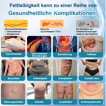 Online🔥 | VIVIREAL® 𝐆𝐋𝐏-𝟏 𝐃𝐫𝐞𝐢𝐟𝐚𝐜𝐡-𝐀𝐠𝐨𝐧𝐢𝐬𝐭 𝐌𝐮𝐥𝐭𝐢𝐟𝐮𝐧𝐤𝐭𝐢𝐨𝐧𝐚𝐥𝐞 𝐎𝐫𝐚𝐥𝐥ö𝐬𝐮𝐧𝐠 (𝐍ä𝐜𝐡𝐬𝐭𝐞 𝐆𝐞𝐧𝐞𝐫𝐚𝐭𝐢𝐨𝐧 𝐆𝐋𝐏-𝟏 × 𝐆𝐈𝐏 × 𝐆𝐂𝐆 𝐀𝐠𝐨𝐧𝐢𝐬𝐭) ✅ 𝐅ü𝐫 𝐅𝐞𝐭𝐭𝐥𝐞𝐢𝐛𝐢𝐠𝐤𝐞𝐢𝐭, 𝐇𝐞𝐫𝐳-𝐊𝐫𝐞𝐢𝐬𝐥𝐚𝐮𝐟-𝐆𝐞𝐬𝐮𝐧𝐝𝐡𝐞𝐢𝐭, 𝐃𝐢𝐚𝐛𝐞𝐭𝐞𝐬, 𝐒𝐜𝐡𝐥𝐚𝐟𝐚𝐩𝐧𝐨𝐞, 𝐆𝐥𝐞𝐢𝐜𝐡𝐞𝐰𝐢𝐜𝐡𝐭𝐬- 𝐮𝐧𝐝 𝐆𝐞𝐥𝐞𝐧𝐤𝐩𝐫𝐨𝐛𝐥𝐞𝐦𝐞 𝐮𝐧𝐝 𝐦𝐞𝐡𝐫.