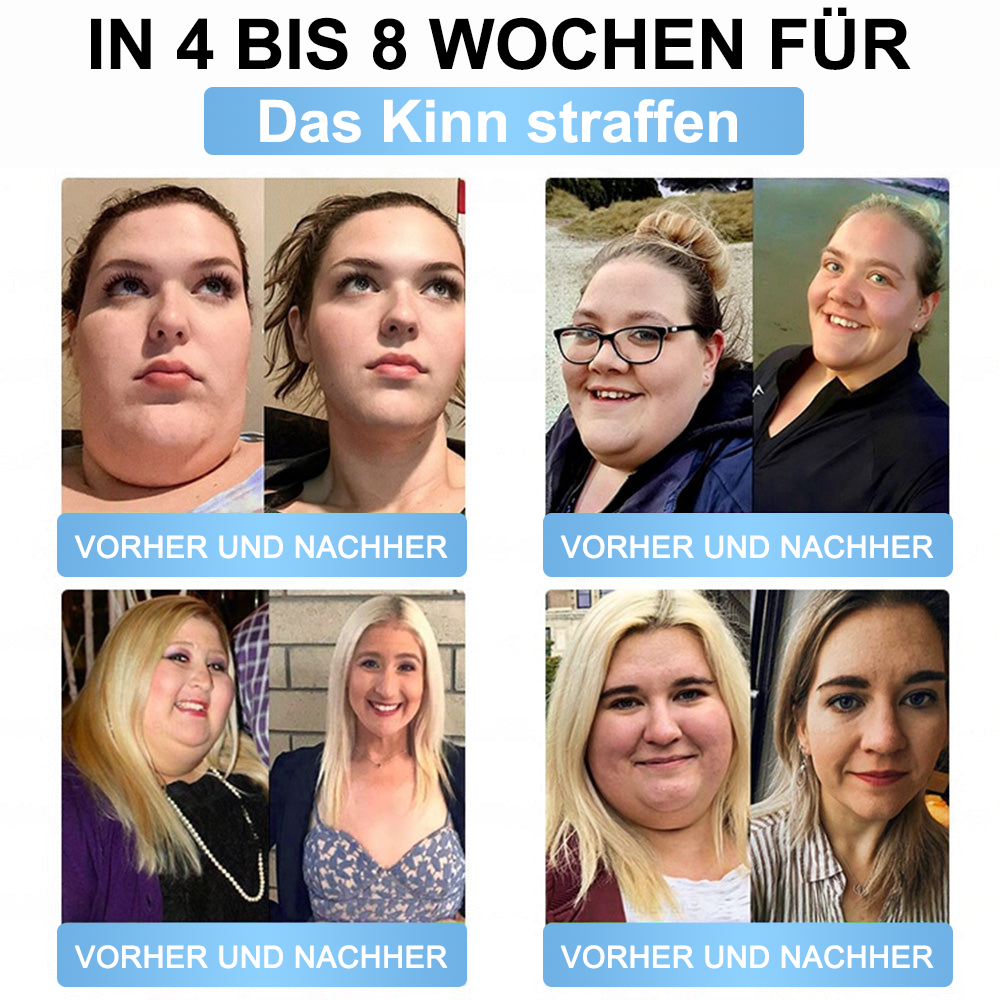 Offizieller Store | Honxi® Longevity GLP-1 8-in-1 Schlank & Gesund Lösung zum Einnehmen (Einmal täglich, sichtbare Ergebnisse in 7 Tagen) Unterstützt Adipositas, Herz-Kreislauf-Gesundheit, Diabetes, Schlafapnoe, Darmgesundheit