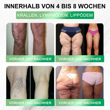 Neuerscheinung 🇩🇪｜Croaie® GLP-1 20-in-1 Slim & Health Oral Solution -Nur eine Dosis pro Tag, sichtbare Ergebnisse in nur 6 Tagen!Enthält 100 Milliarden aktive Probiotika (CFU). ✅ Unterstützt das Gewichtsmanagement, die Herzgesundheit